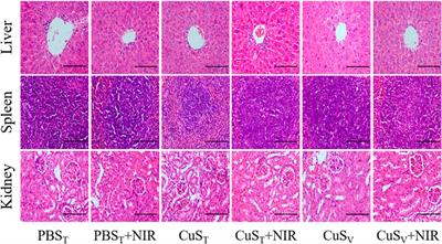 Photothermal effects of CuS-BSA nanoparticles on H22 hepatoma-bearing mice